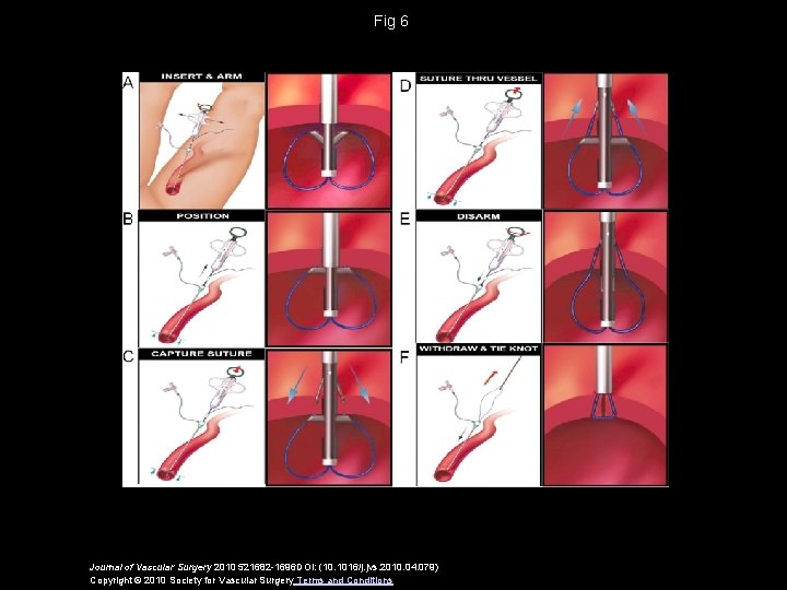 Fig 6 Journal of Vascular Surgery 2010 521682 -1696 DOI: (10. 1016/j. jvs. 2010.