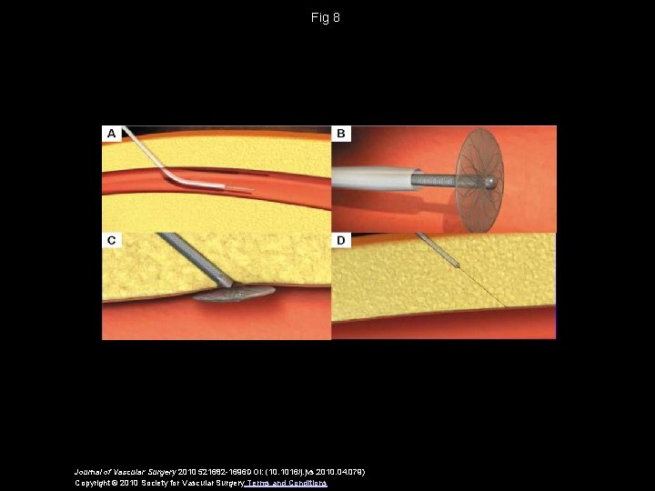 Fig 8 Journal of Vascular Surgery 2010 521682 -1696 DOI: (10. 1016/j. jvs. 2010.