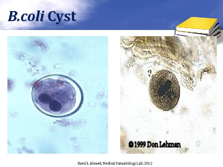 B. coli Cyst Raed Z. Ahmed, Medical Parasitology Lab. , 2012 