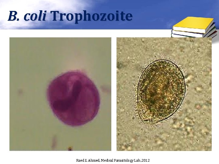 B. coli Trophozoite Raed Z. Ahmed, Medical Parasitology Lab. , 2012 