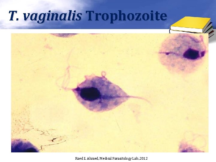 T. vaginalis Trophozoite Raed Z. Ahmed, Medical Parasitology Lab. , 2012 