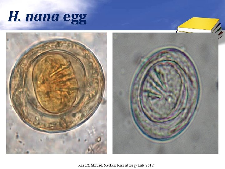 H. nana egg Raed Z. Ahmed, Medical Parasitology Lab. , 2012 