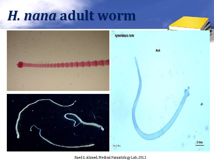 H. nana adult worm Raed Z. Ahmed, Medical Parasitology Lab. , 2012 