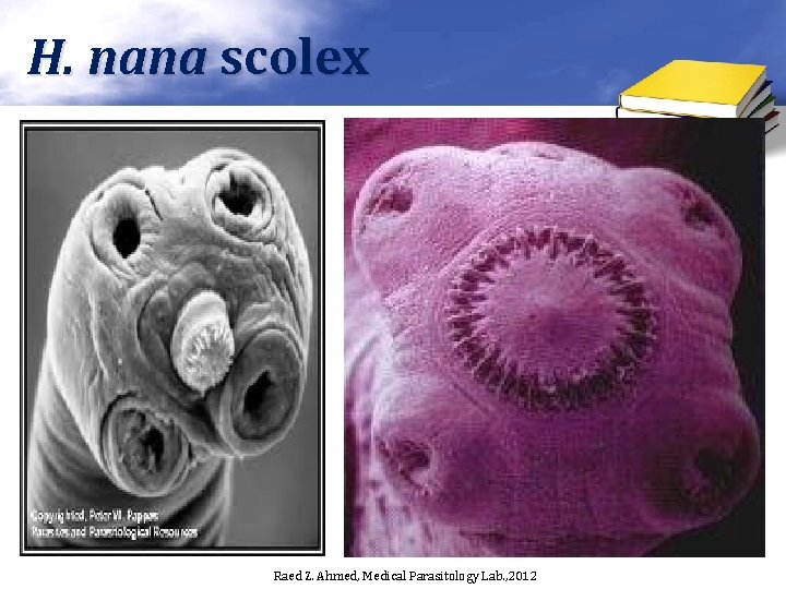 H. nana scolex Raed Z. Ahmed, Medical Parasitology Lab. , 2012 