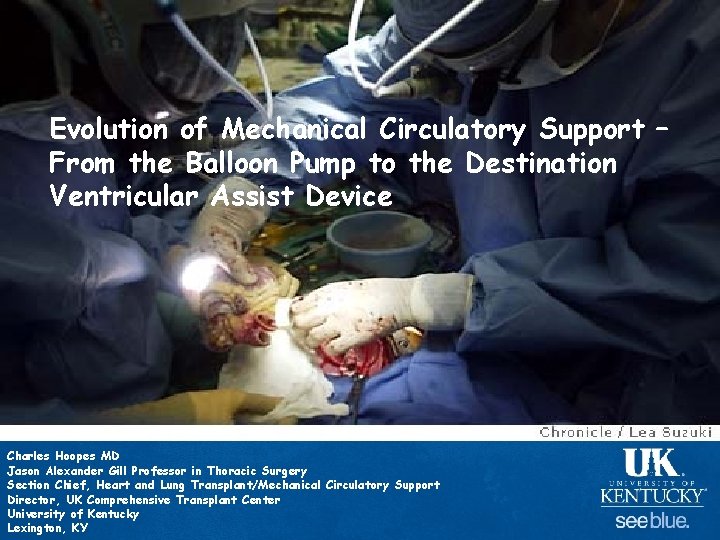 Evolution of Mechanical Circulatory Support – From the Balloon Pump to the Destination Ventricular