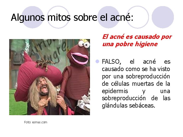 Algunos mitos sobre el acné: El acné es causado por una pobre higiene l Algunos mitos sobre el acné: El acné es causado por una pobre higiene l