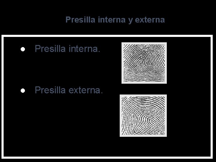 Presilla interna y externa l Presilla interna. l Presilla externa. 20 