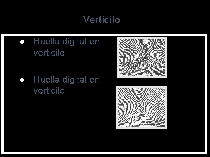 Verticilo l Huella digital en verticilo 21 