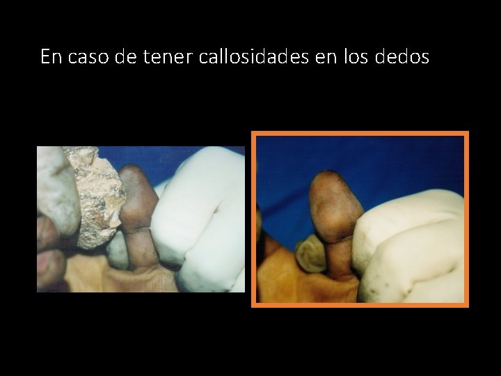 En caso de tener callosidades en los dedos 39 