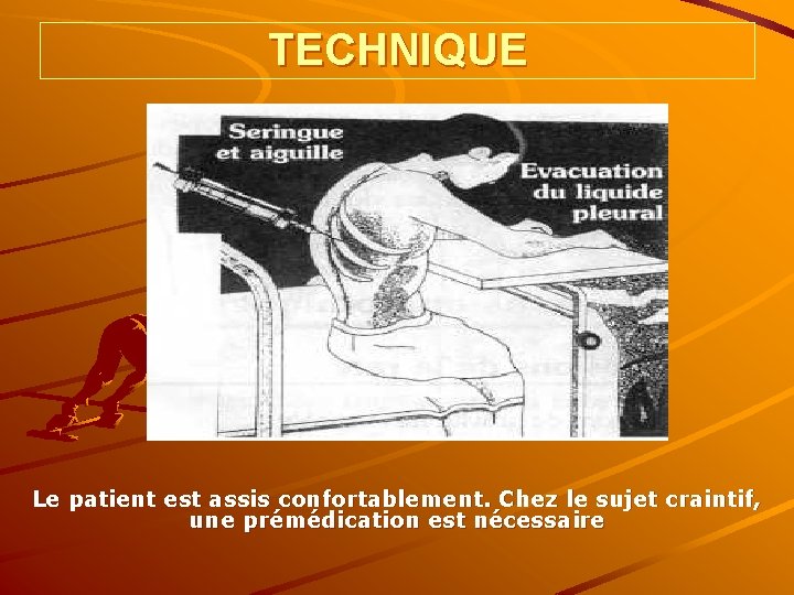 TECHNIQUE Le patient est assis confortablement. Chez le sujet craintif, une prémédication est nécessaire