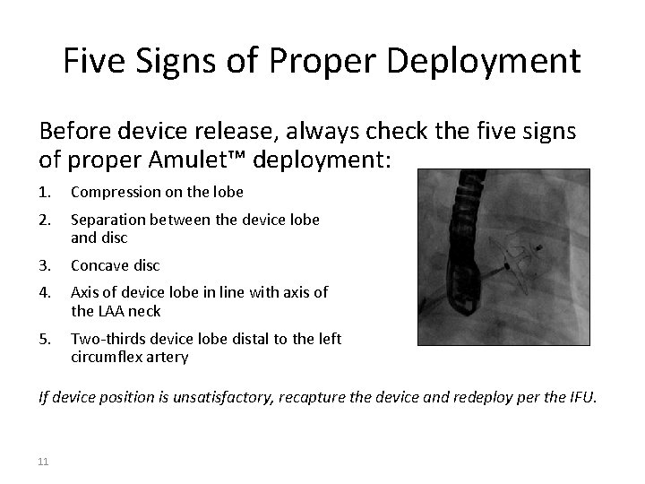Five Signs of Proper Deployment Before device release, always check the five signs of