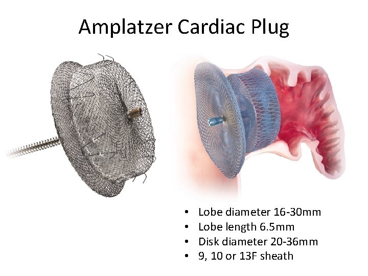 Amplatzer Cardiac Plug • • Lobe diameter 16 -30 mm Lobe length 6. 5