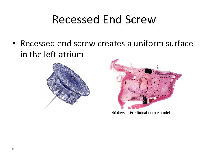 Recessed End Screw • Recessed end screw creates a uniform surface in the left