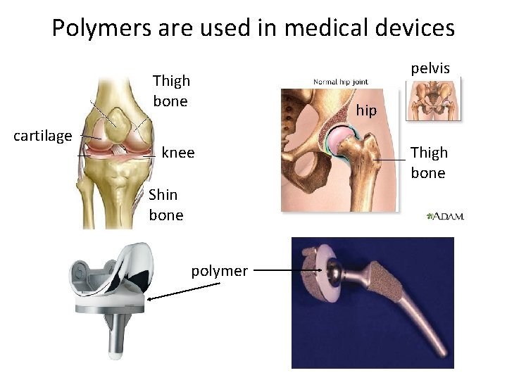 Polymers are used in medical devices pelvis Thigh bone cartilage hip knee Shin bone