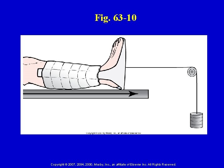 Fig. 63 -10 Copyright © 2007, 2004, 2000, Mosby, Inc. , an affiliate of