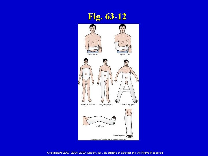 Fig. 63 -12 Copyright © 2007, 2004, 2000, Mosby, Inc. , an affiliate of