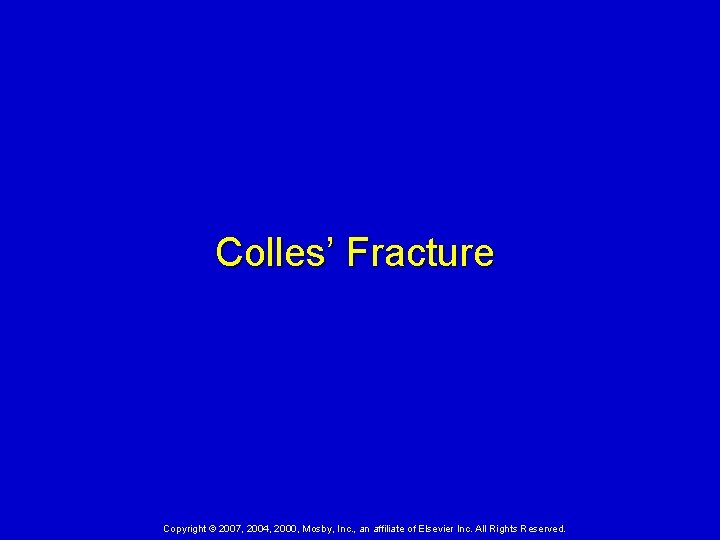 Colles’ Fracture Copyright © 2007, 2004, 2000, Mosby, Inc. , an affiliate of Elsevier