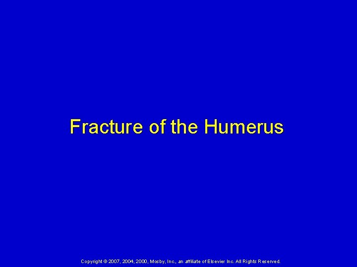 Fracture of the Humerus Copyright © 2007, 2004, 2000, Mosby, Inc. , an affiliate