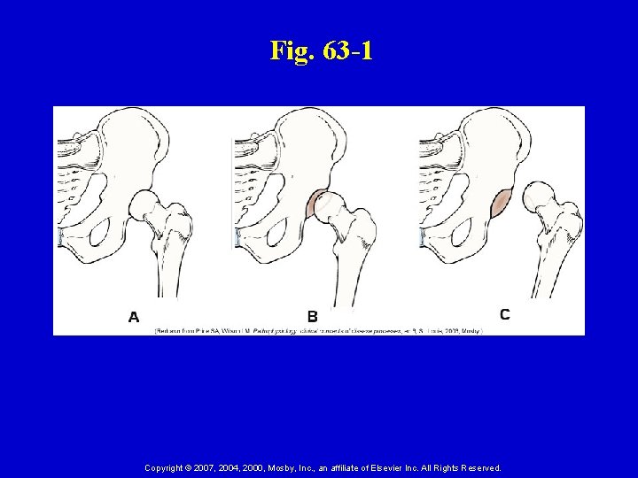 Fig. 63 -1 Copyright © 2007, 2004, 2000, Mosby, Inc. , an affiliate of