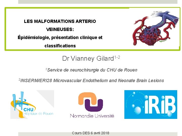 LES MALFORMATIONS ARTERIO VEINEUSES: Épidémiologie, présentation clinique et classifications Dr Vianney Gilard 1 -2