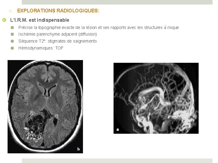 o EXPLORATIONS RADIOLOGIQUES: L'I. R. M. est indispensable Précise la topographie exacte de la