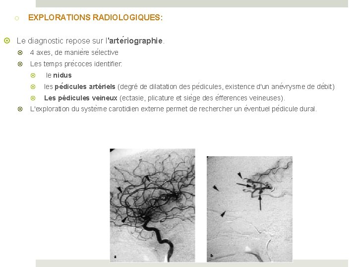 o EXPLORATIONS RADIOLOGIQUES: Le diagnostic repose sur l'arte riographie. 4 axes, de manie re