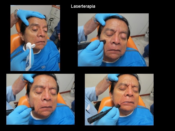 Laserterapia 