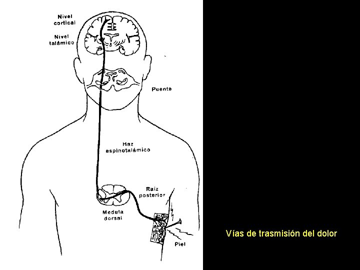 Vías de trasmisión del dolor 