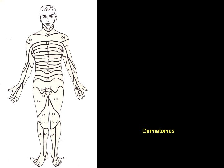 Dermatomas 