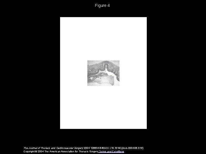 Figure 4 The Journal of Thoracic and Cardiovascular Surgery 2004 128834 -840 DOI: (10.