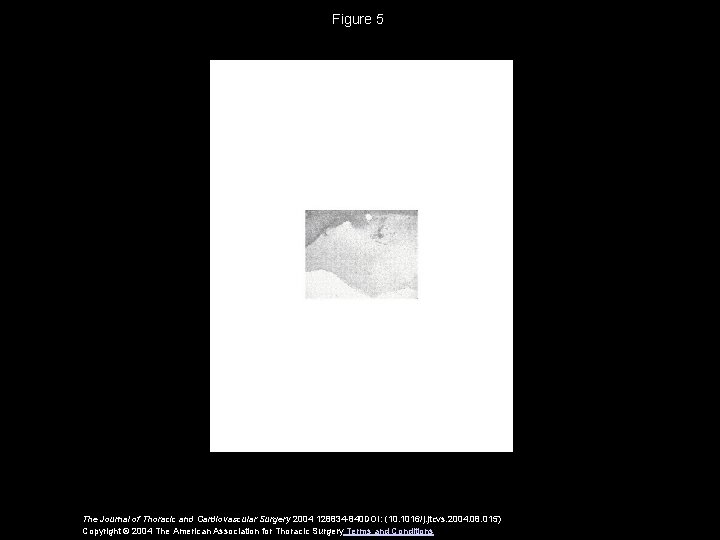 Figure 5 The Journal of Thoracic and Cardiovascular Surgery 2004 128834 -840 DOI: (10.