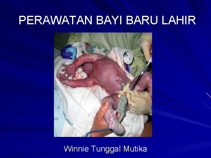 PERAWATAN BAYI BARU LAHIR Winnie Tunggal Mutika 