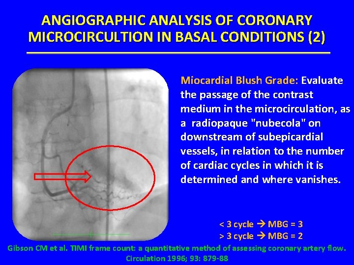 ANGIOGRAPHIC ANALYSIS OF CORONARY MICROCIRCULTION IN BASAL CONDITIONS (2) Miocardial Blush Grade: Evaluate the