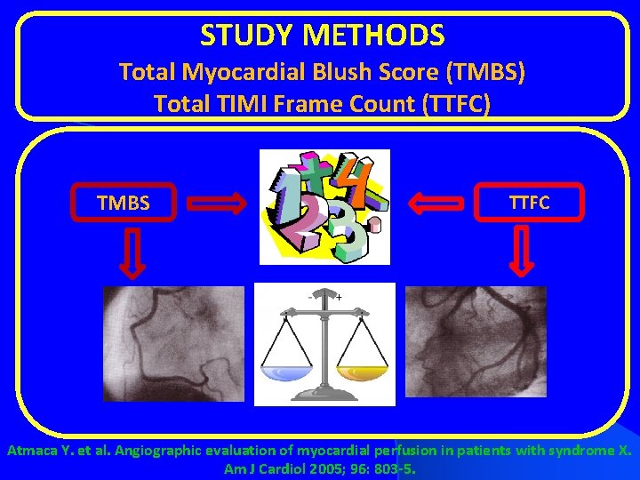 STUDY METHODS Total Myocardial Blush Score (TMBS) Total TIMI Frame Count (TTFC) TMBS TTFC