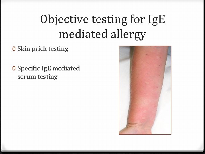 Objective testing for Ig. E mediated allergy 0 Skin prick testing 0 Specific Ig.