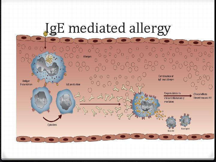 Ig. E mediated allergy 