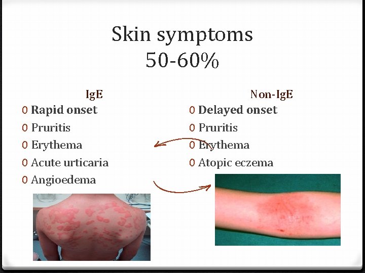 Skin symptoms 50 -60% Ig. E 0 Rapid onset 0 Pruritis 0 Erythema 0