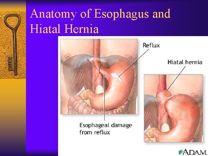 Anatomy of Esophagus and Hiatal Hernia 