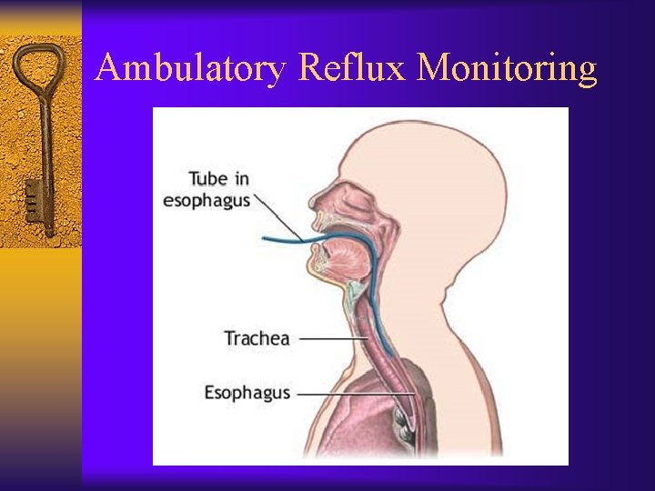 Ambulatory Reflux Monitoring 