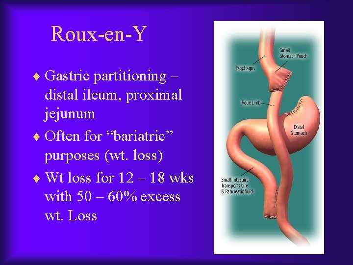 Roux-en-Y ¨ Gastric partitioning – distal ileum, proximal jejunum ¨ Often for “bariatric” purposes