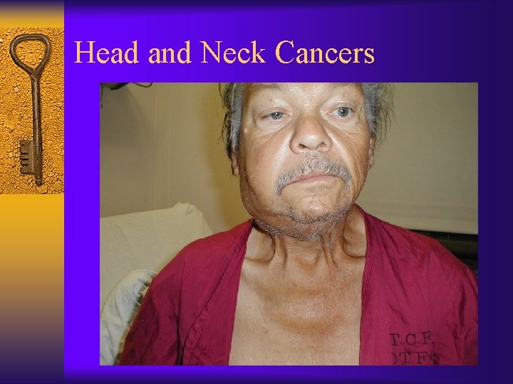 Head and Neck Cancers 