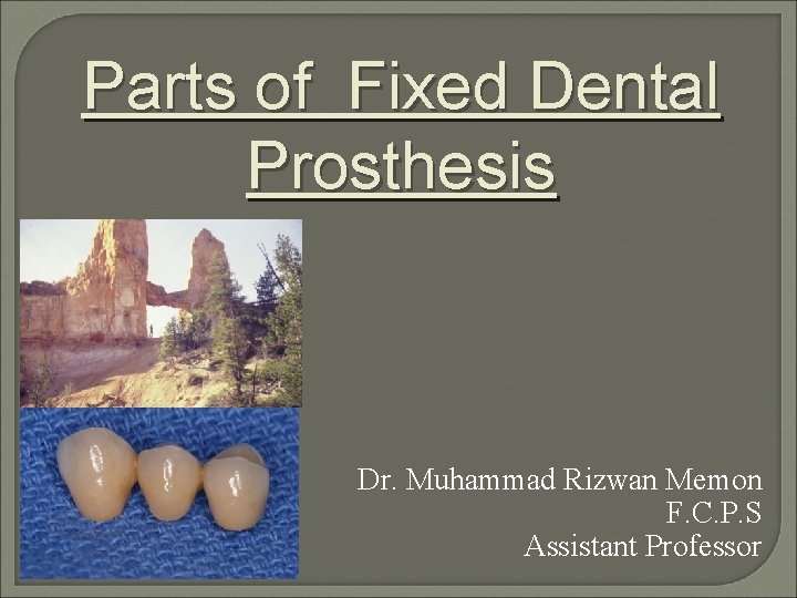 Parts of Fixed Dental Prosthesis Dr. Muhammad Rizwan Memon F. C. P. S Assistant