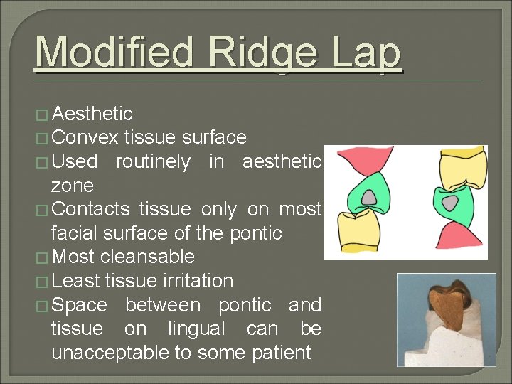 Modified Ridge Lap � Aesthetic � Convex tissue surface � Used routinely in aesthetic