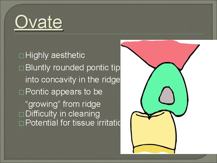 Ovate � Highly aesthetic � Bluntly rounded pontic tip set into concavity in the