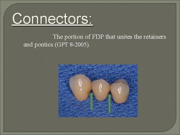 Connectors: The portion of FDP that unites the retainers and pontics (GPT 8 -2005).