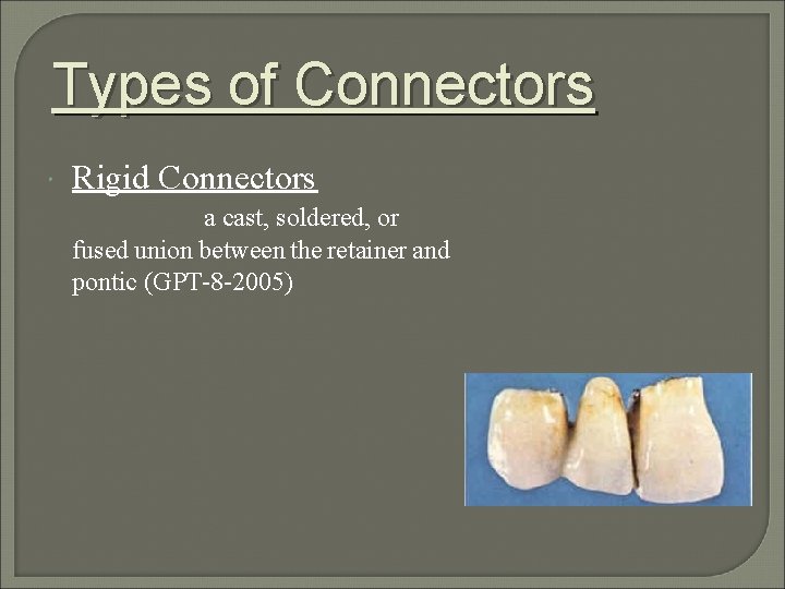 Types of Connectors Rigid Connectors a cast, soldered, or fused union between the retainer