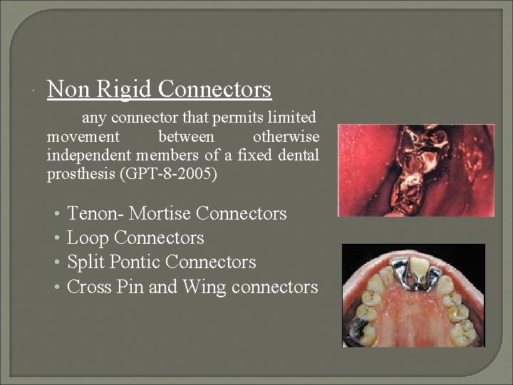  Non Rigid Connectors any connector that permits limited movement between otherwise independent members