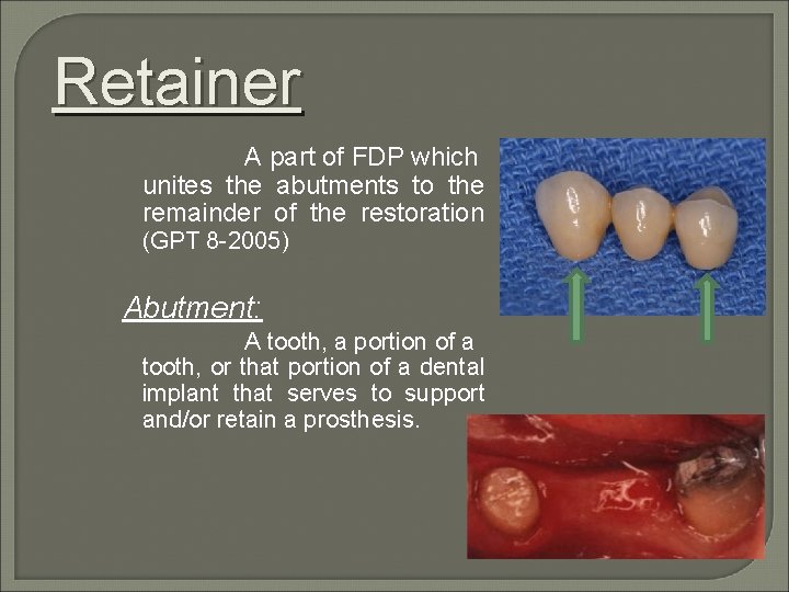 Retainer A part of FDP which unites the abutments to the remainder of the