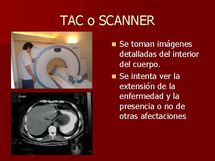 TAC o SCANNER Se toman imágenes detalladas del interior del cuerpo. n Se intenta