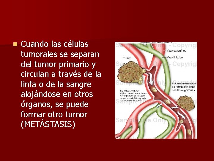 n Cuando las células tumorales se separan del tumor primario y circulan a través